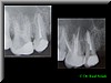 molar superior 2.jpg